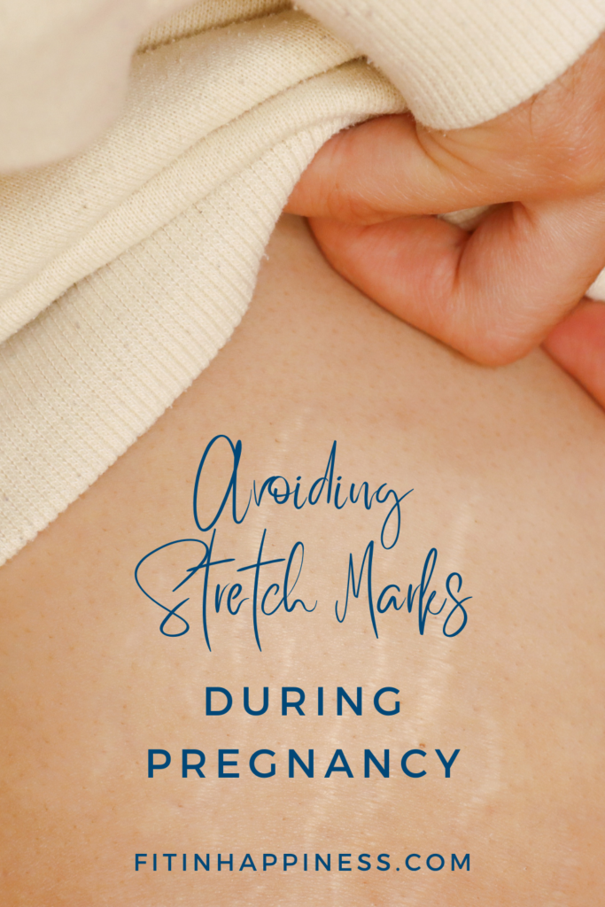 Avoiding stretch marks during pregnancy